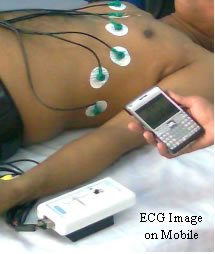 Handheld 12-Channel Tele-ECG Instrument