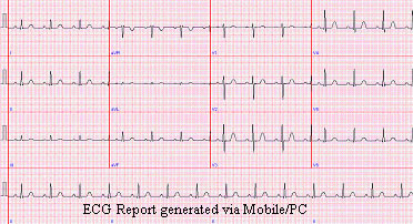 Handheld 12-Channel Tele-ECG Instrument