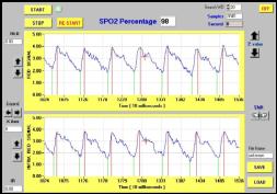 Oximeter Module